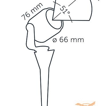 Big Scope